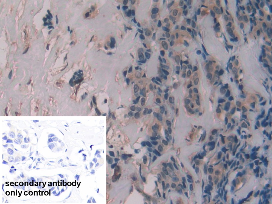 Polyclonal Antibody to Alanine Aminotransferase (ALT)