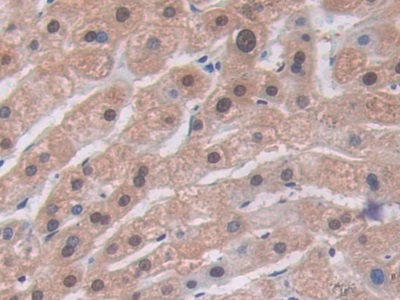Polyclonal Antibody to Alanine Aminotransferase (ALT)