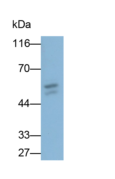 Polyclonal Antibody to Alanine Aminotransferase (ALT)