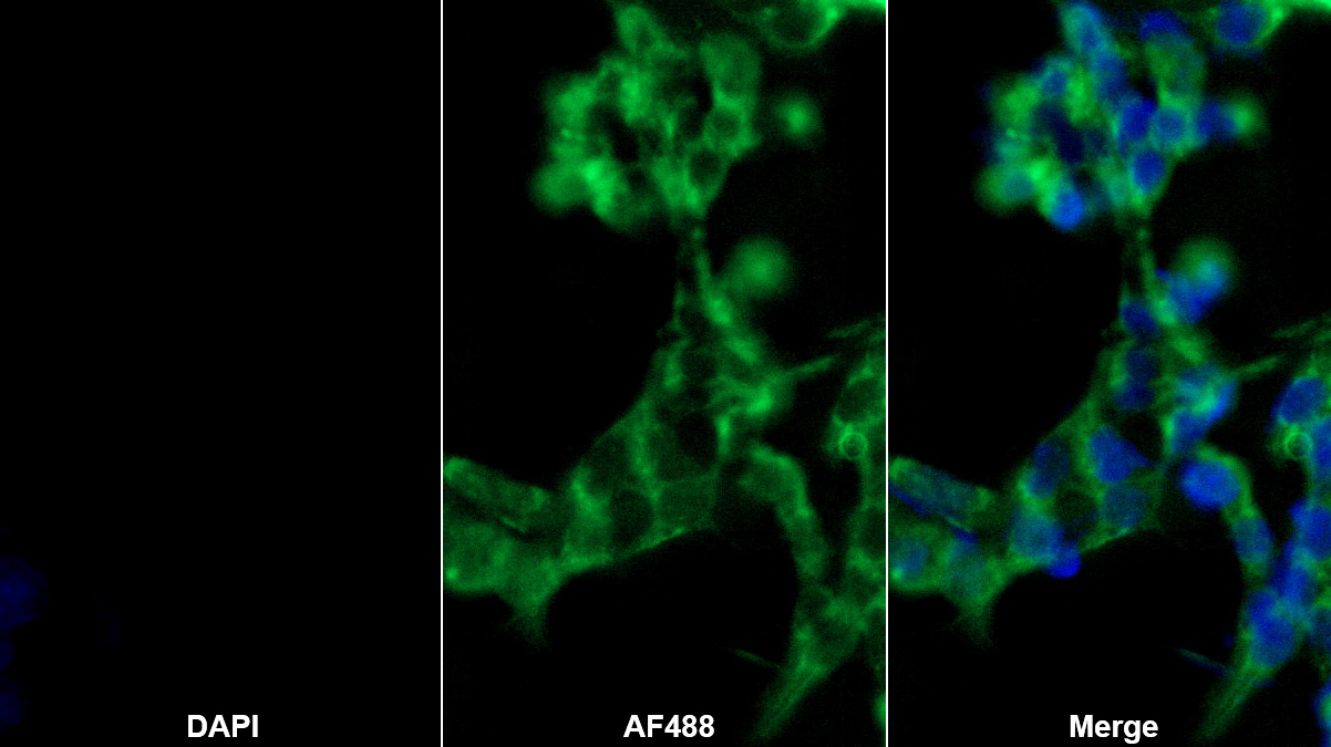 Polyclonal Antibody to Alanine Aminotransferase (ALT)