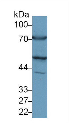 Polyclonal Antibody to Alanine Aminotransferase (ALT)