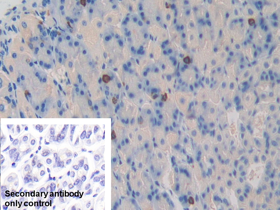 Polyclonal Antibody to Matrix Metalloproteinase 23B (MMP23B)