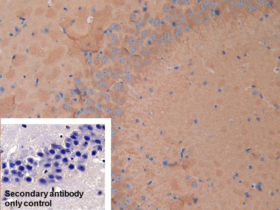 Polyclonal Antibody to Matrix Metalloproteinase 23B (MMP23B)