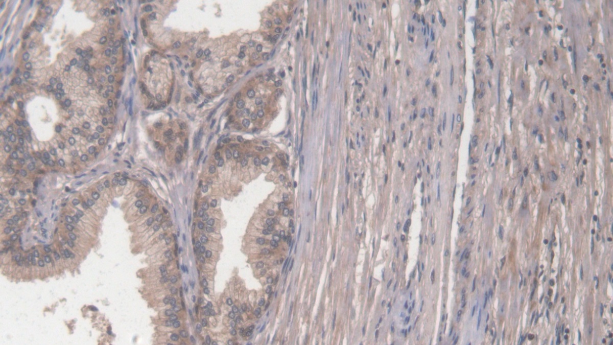 Polyclonal Antibody to Collagen Type I Alpha 2 (COL1a2)