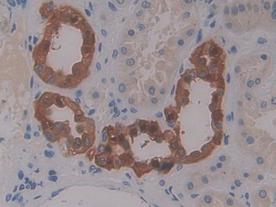 Polyclonal Antibody to Monocyte Chemotactic Protein 4 (MCP4)