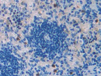 Polyclonal Antibody to Transforming Growth Factor Beta 2 (TGFb2)