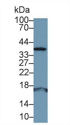 Polyclonal Antibody to Adrenomedullin (ADM)