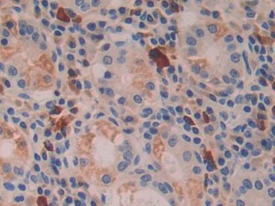 Polyclonal Antibody to Interferon Beta (IFNb)
