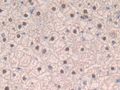 Polyclonal Antibody to Interferon Beta (IFNb)