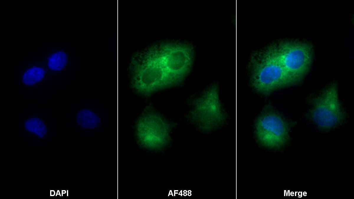 Polyclonal Antibody to Cyclophilin B (CYPB)