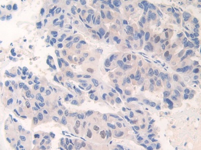 Polyclonal Antibody to Centromere Protein I (CENPI)