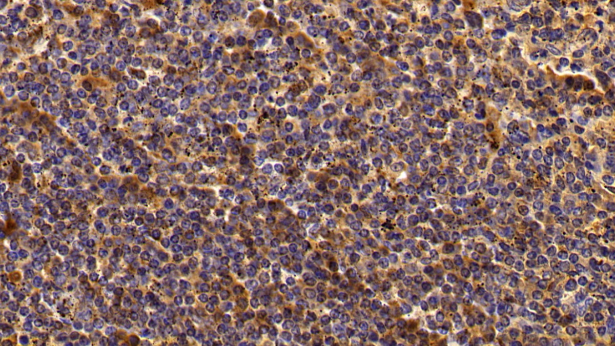 Polyclonal Antibody to Immunoglobulin G4 (IgG4)