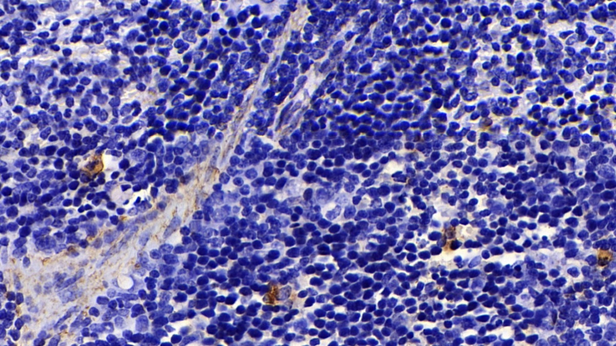 Polyclonal Antibody to Immunoglobulin G4 (IgG4)