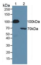 Polyclonal Antibody to Complement 1 Inhibitor (C1INH)