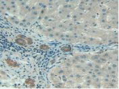 Polyclonal Antibody to Complement 1 Inhibitor (C1INH)