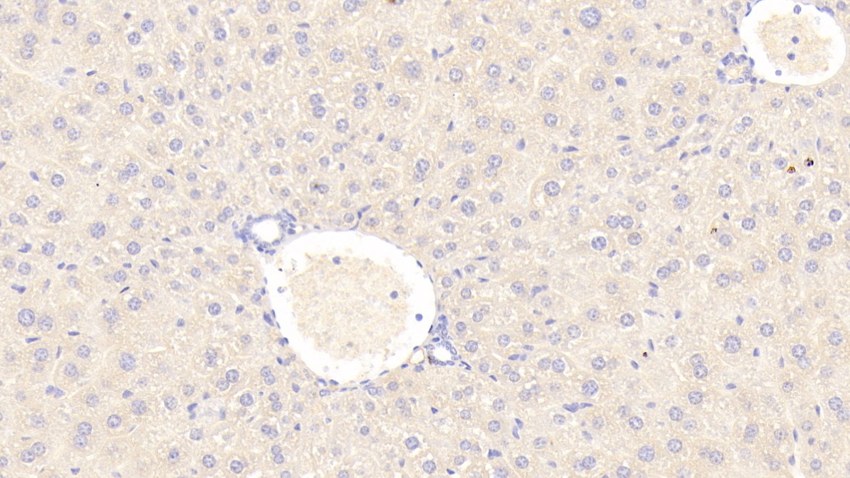 Polyclonal Antibody to Complement 1 Inhibitor (C1INH)