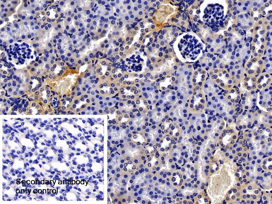 Polyclonal Antibody to Complement 1 Inhibitor (C1INH)