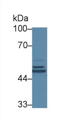 Polyclonal Antibody to Complement 1 Inhibitor (C1INH)