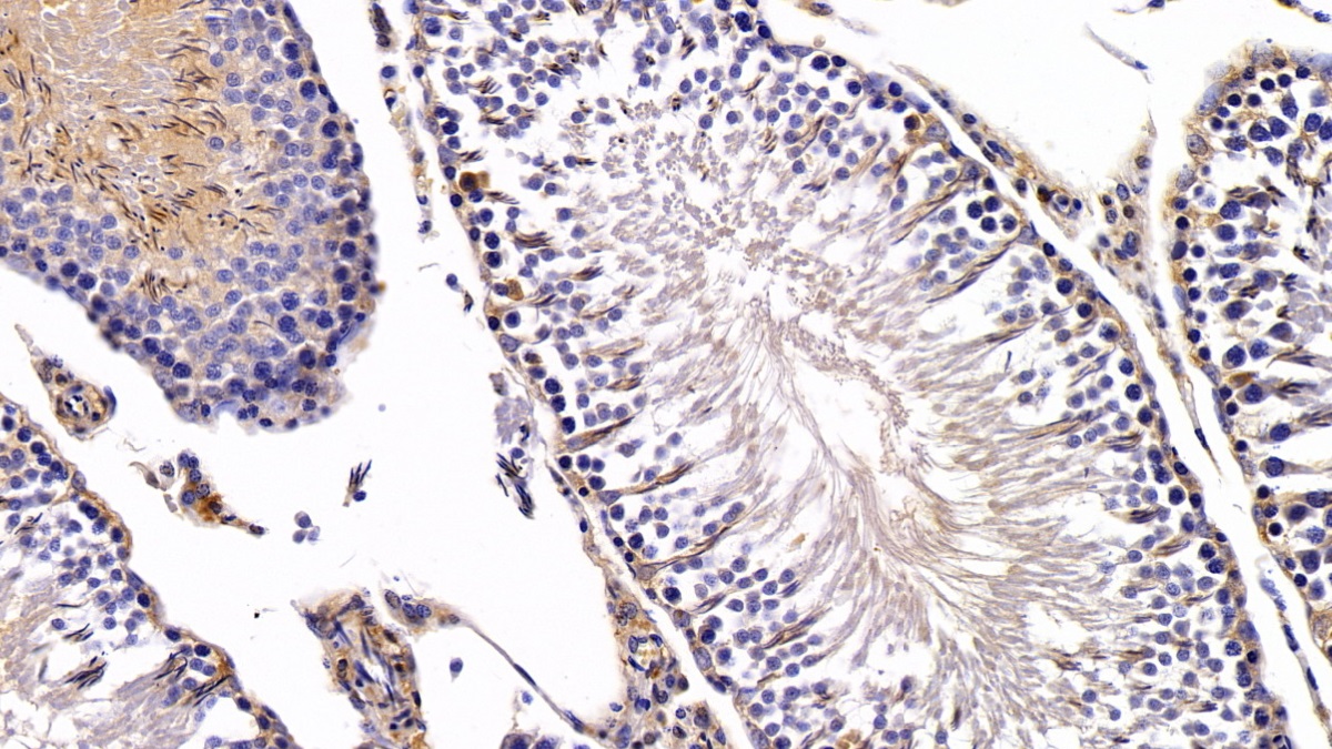 Polyclonal Antibody to Nesfatin 1 (NES1)