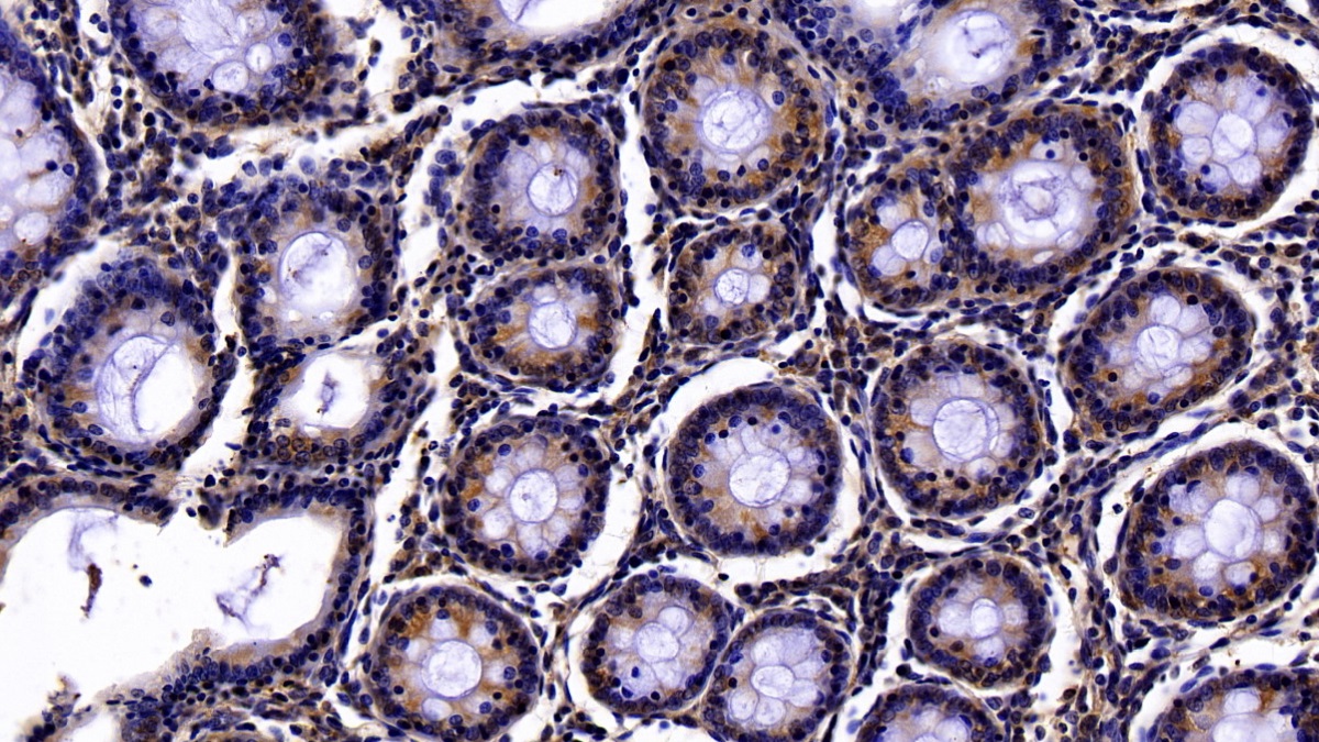 Polyclonal Antibody to Paraoxonase 1 (PON1)