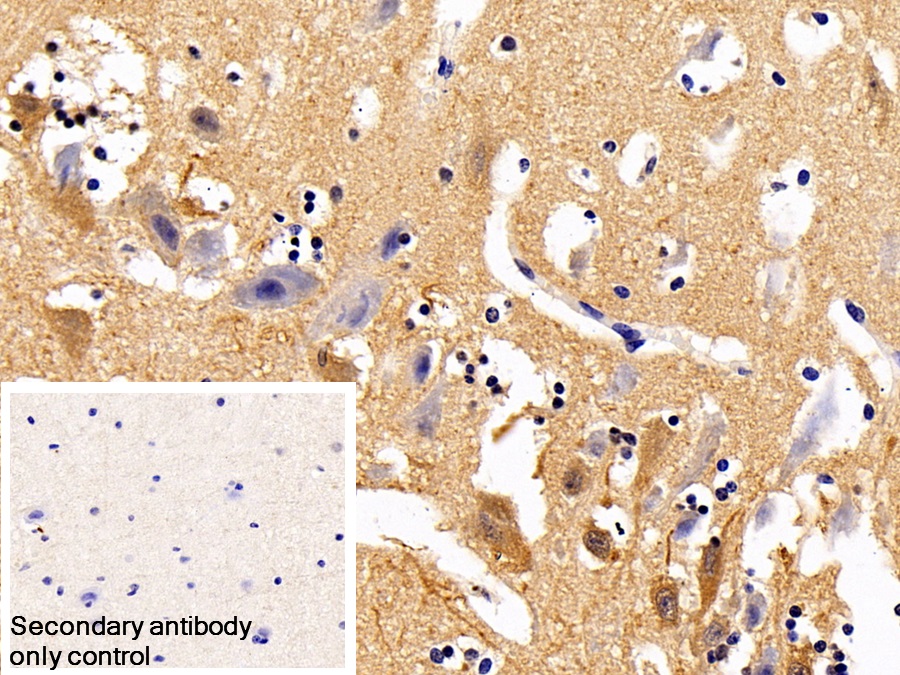 Polyclonal Antibody to Paraoxonase 1 (PON1)