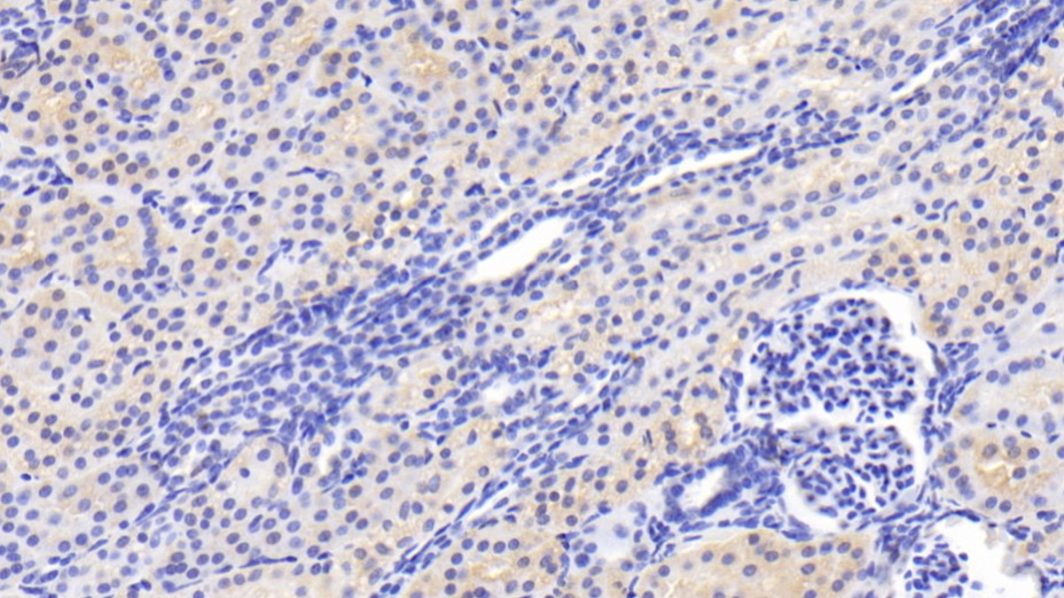 Polyclonal Antibody to Caspase 2 (CASP2)