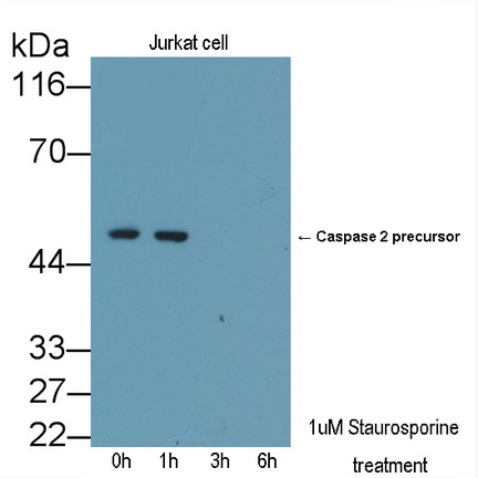 Polyclonal Antibody to Caspase 2 (CASP2)
