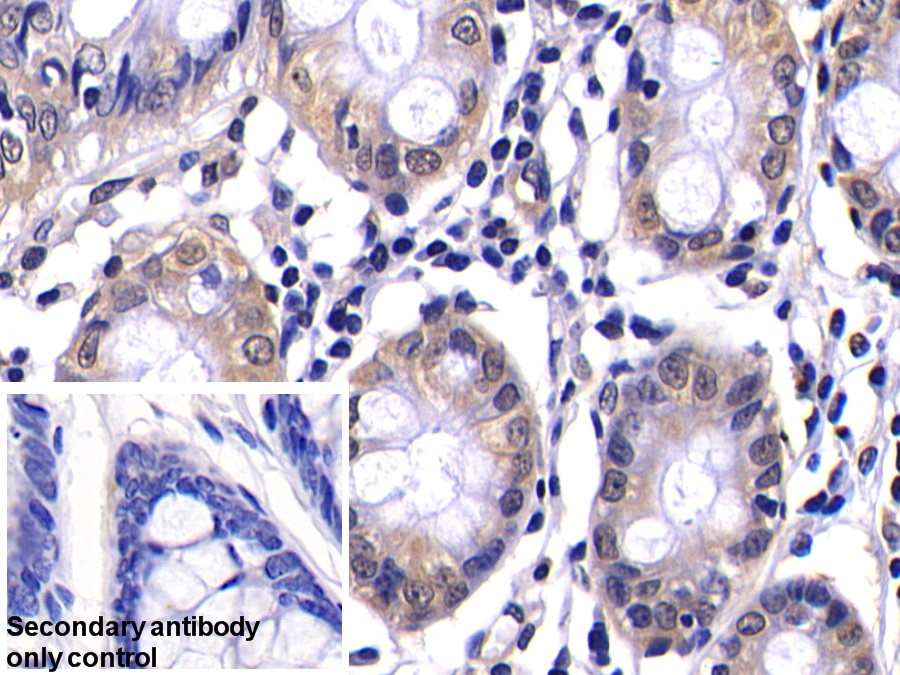 Polyclonal Antibody to Caspase 2 (CASP2)