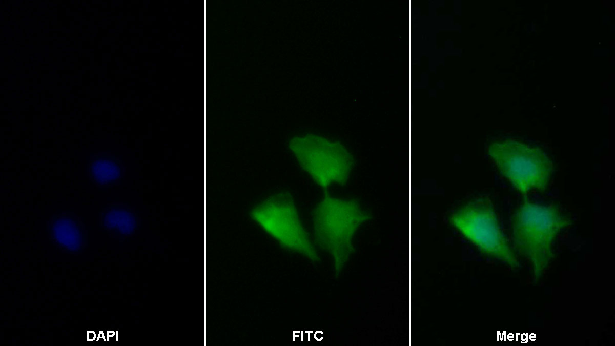 Polyclonal Antibody to Caspase 2 (CASP2)