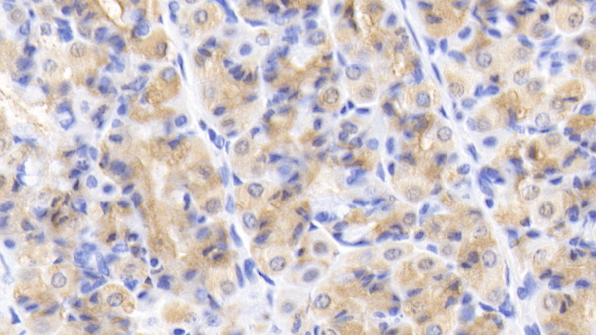 Polyclonal Antibody to Caspase 2 (CASP2)