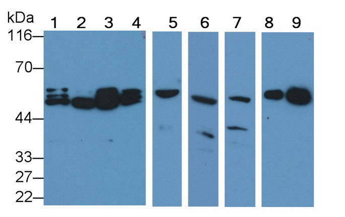 Polyclonal Antibody to Caspase 2 (CASP2)