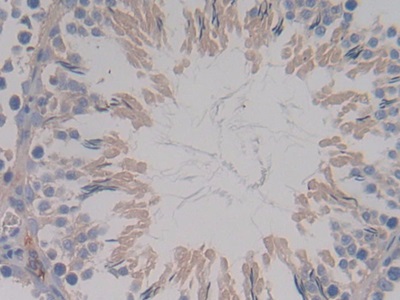 Polyclonal Antibody to Apolipoprotein C1 (APOC1)