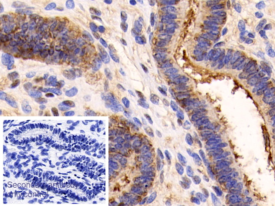 Polyclonal Antibody to Annexin V (ANXA5)