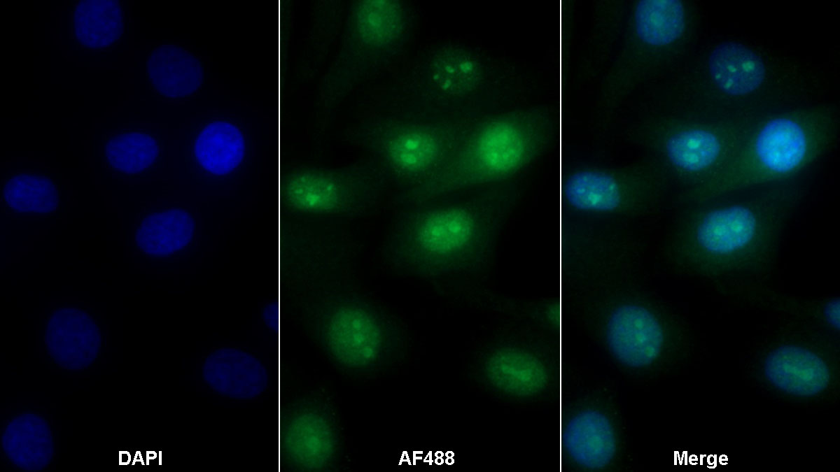 Polyclonal Antibody to Annexin V (ANXA5)