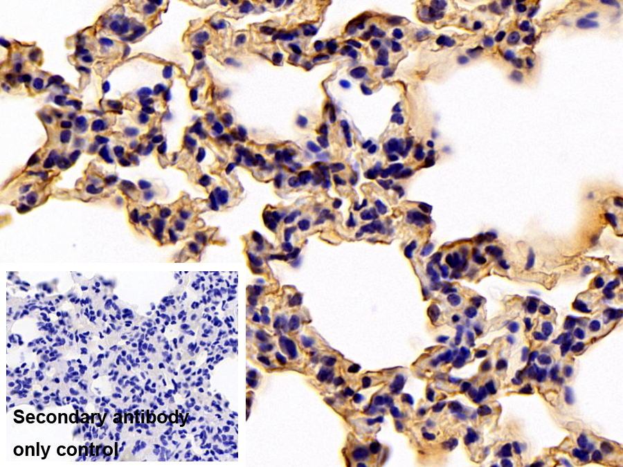 Polyclonal Antibody to Annexin V (ANXA5)