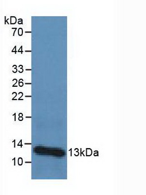 Polyclonal Antibody to Beta-2-Microglobulin (b2M)