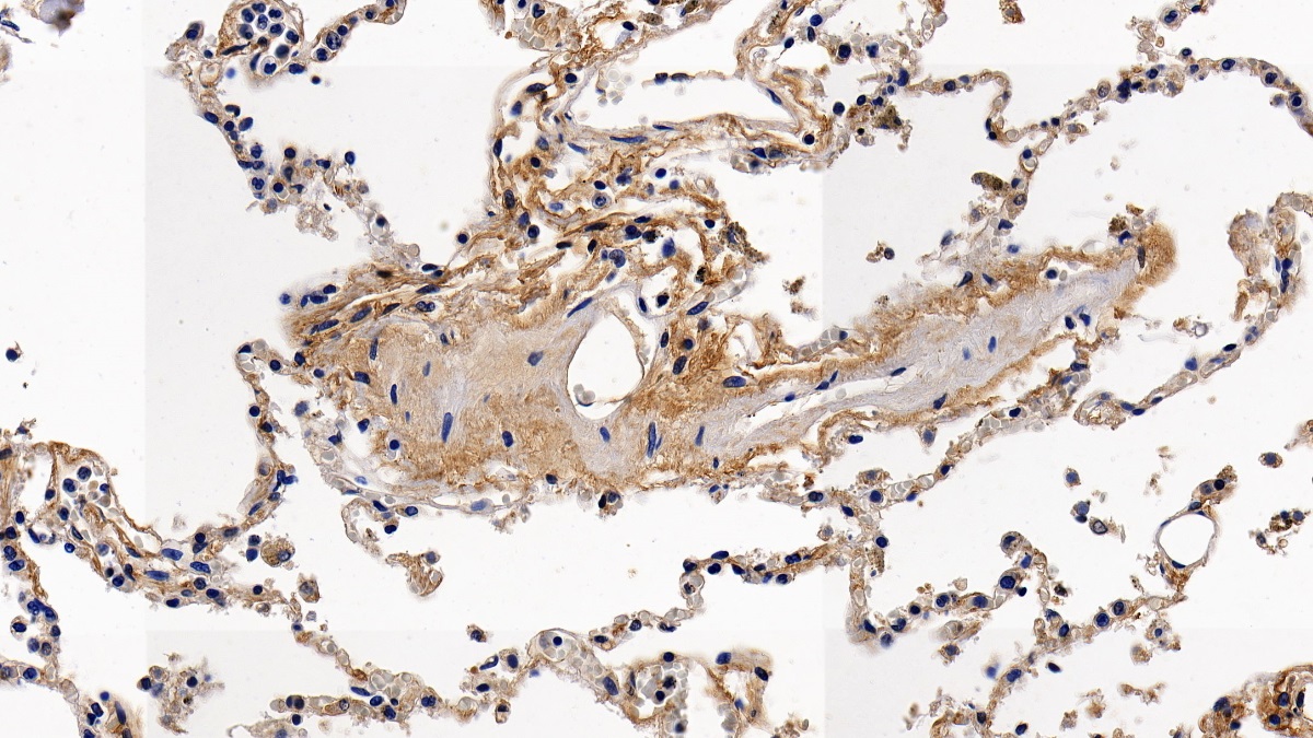 Polyclonal Antibody to Beta-2-Microglobulin (b2M)