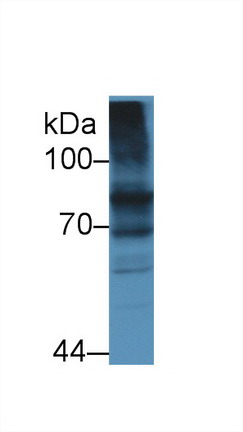 Polyclonal Antibody to Transferrin Receptor 2 (TFR2)