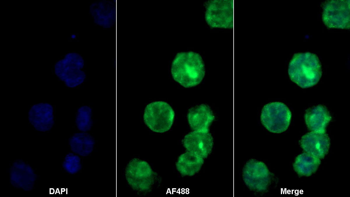 Polyclonal Antibody to Transferrin Receptor 2 (TFR2)