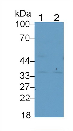 Polyclonal Antibody to Cathepsin K (CTSK)