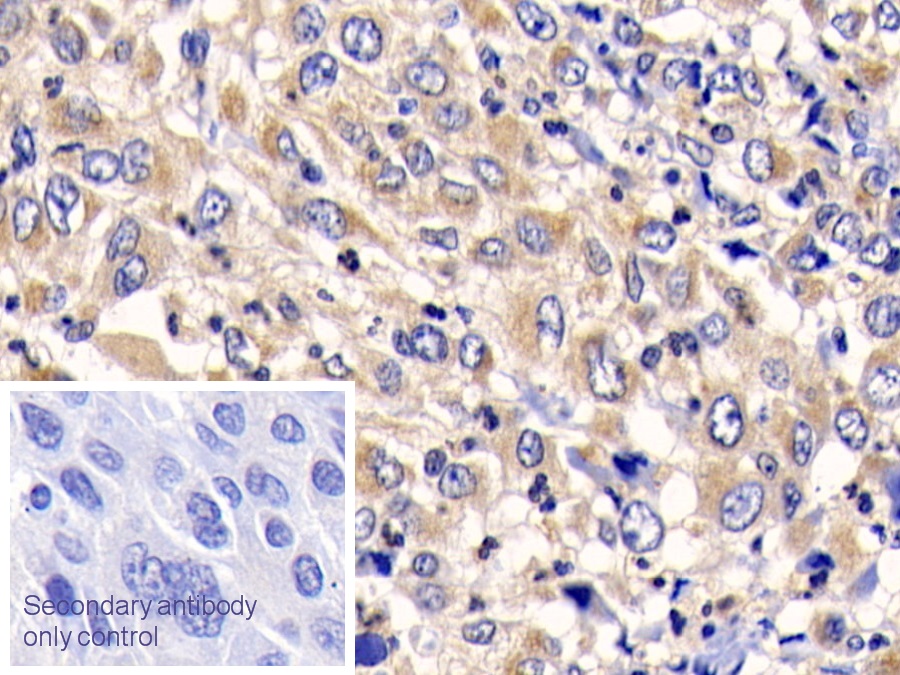 Polyclonal Antibody to Cathepsin K (CTSK)