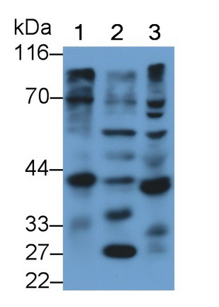 Polyclonal Antibody to Cathepsin K (CTSK)