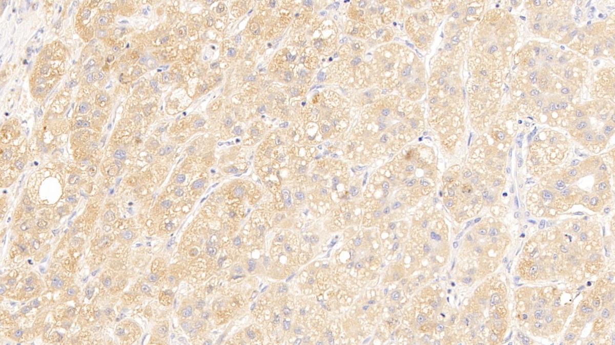 Polyclonal Antibody to Immunoglobulin superfamily, member 1 (IGSF1)