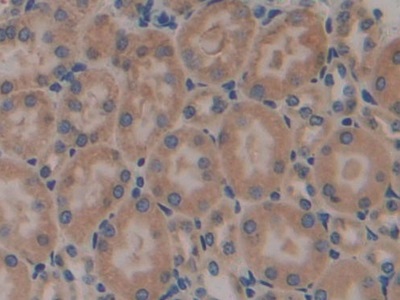 Polyclonal Antibody to Calnexin (CNX)