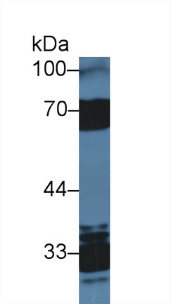 Polyclonal Antibody to Heparin Cofactor II (HCII)