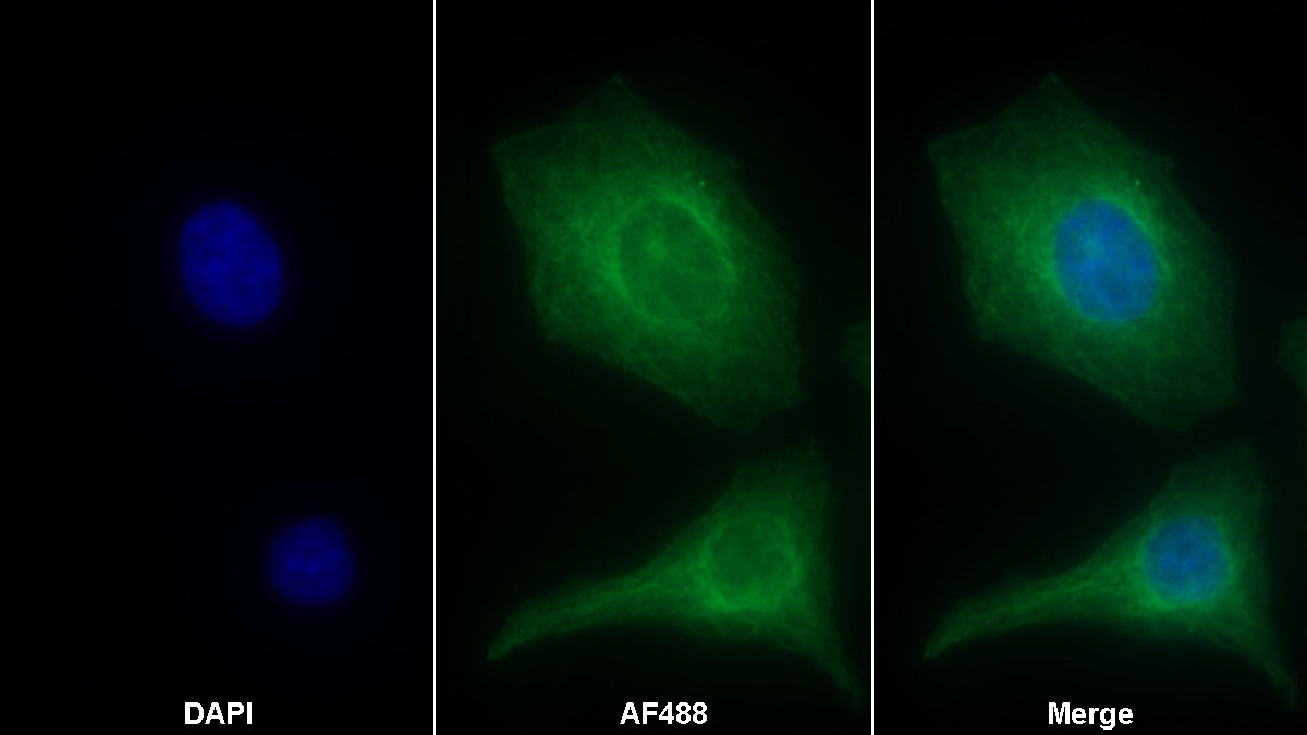 Polyclonal Antibody to Alpha-Fodrin (SPTAN1)