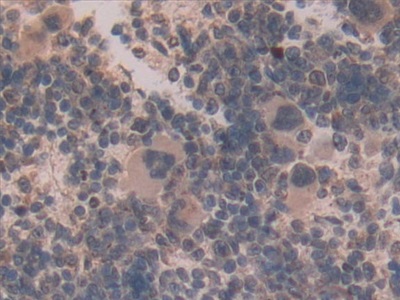 Polyclonal Antibody to Glutamate Dehydrogenase 1 (GLUD1)