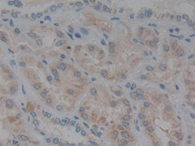 Polyclonal Antibody to Glutathione Peroxidase 1 (GPX1)