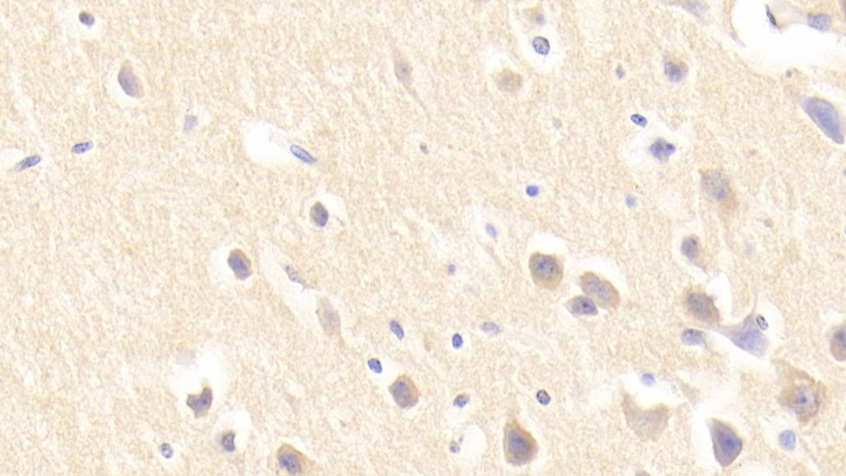 Polyclonal Antibody to Neuronal Pentraxin I (NPTX1)