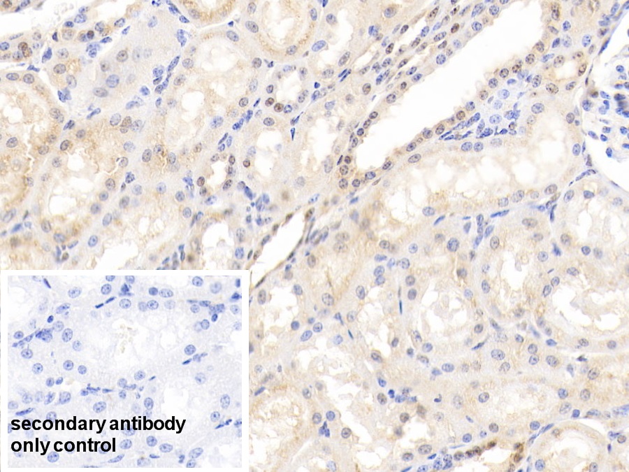 Polyclonal Antibody to Heat Shock 70kDa Protein 1B (HSPA1B)